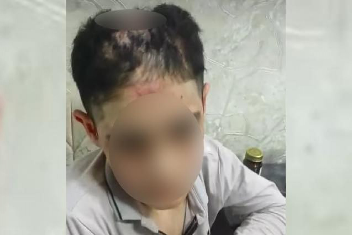 Bakıda yeniyetmə bacısı oğluna işgəncə verməkdə ittiham olunan qadın həbs olunub