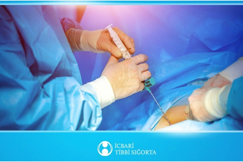 İcbari tibbi sığorta ilə son bir ildə 20-dən çox sümük iliyi transplantasiyası edilib