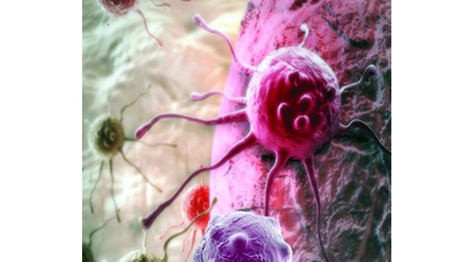 Xərçəng xəstəliyinin yaranmasının 60%-i düzgün qidalanmamaqdır