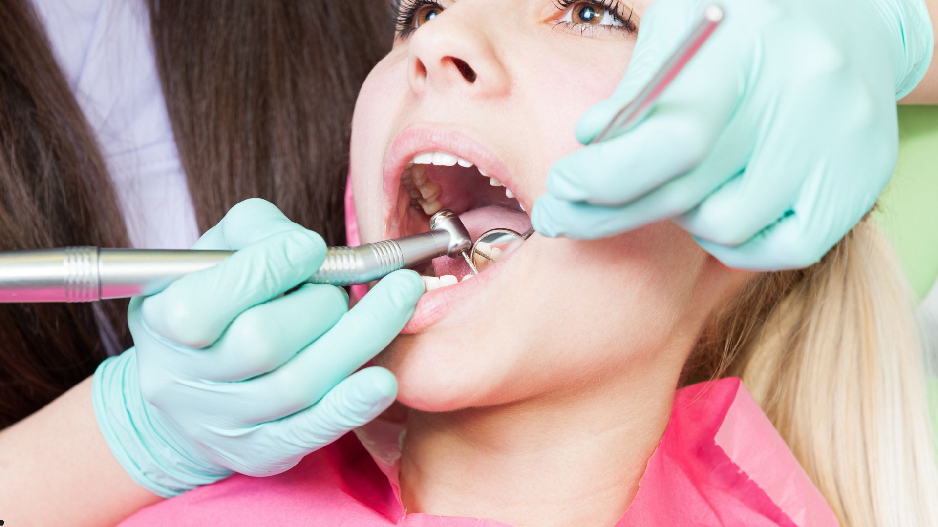 Diş daşları sağlamlıq üçün hansı riskləri yaradır? —