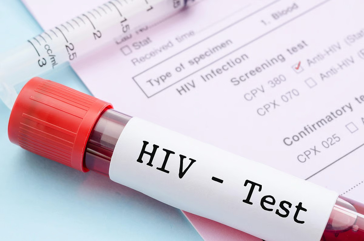 Kişi evlilikdən əvvəl HIV olduğunu gizlətdi – məhkəmə şok qərar verdi