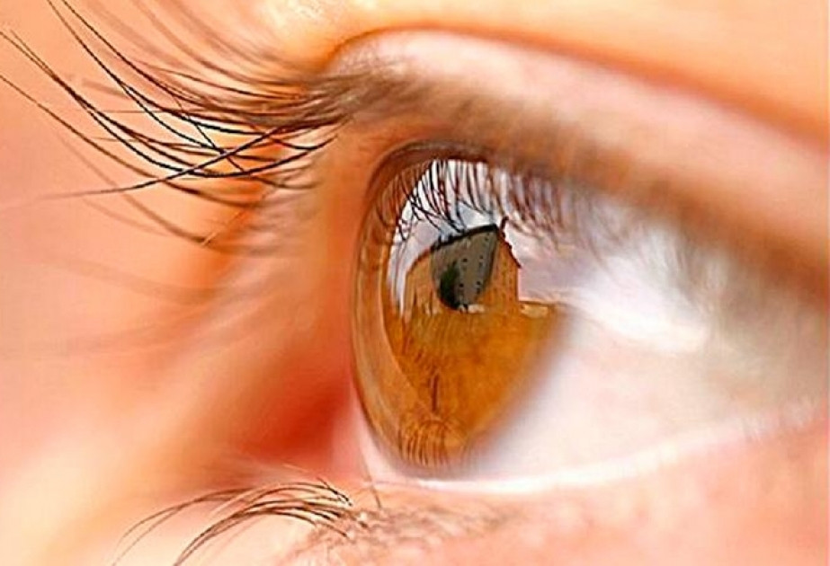 Azərbaycanda ilk: Göz banklı yaradılır