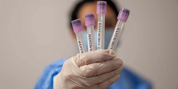 Ukraynanın üç vilayətində hantavirus yayılır