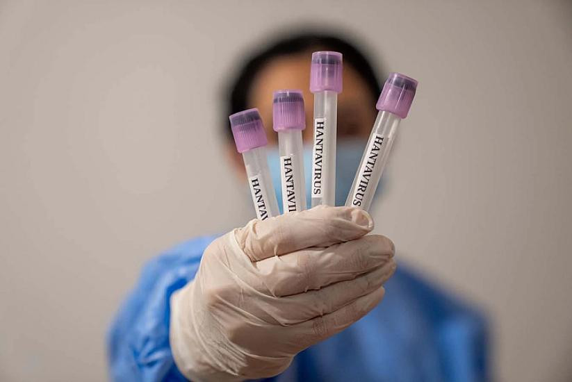 Ukraynanın üç vilayətində hantavirus yayılır