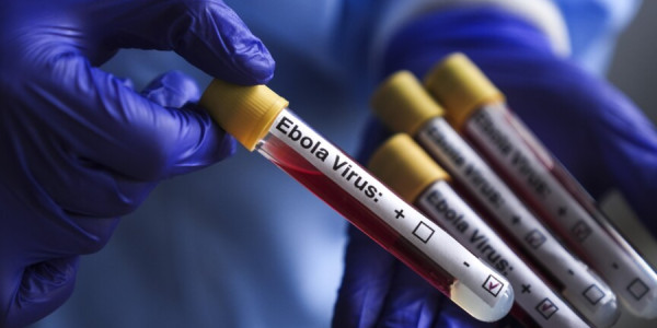 Ebola kabusa çevrilir: Yüksək hərarət, güclü yorğunluq, əzələ ağrıları...