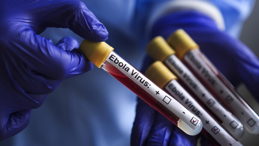 Ebola kabusa çevrilir: Yüksək hərarət, güclü yorğunluq, əzələ ağrıları...