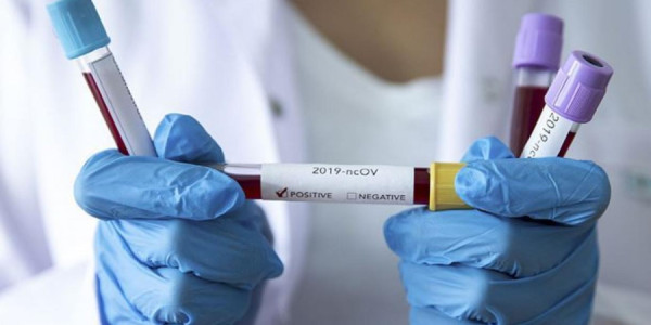 Putinin çıxışını dinləmək istəyənlərdən koronavirus və qrip testi tələb olunur