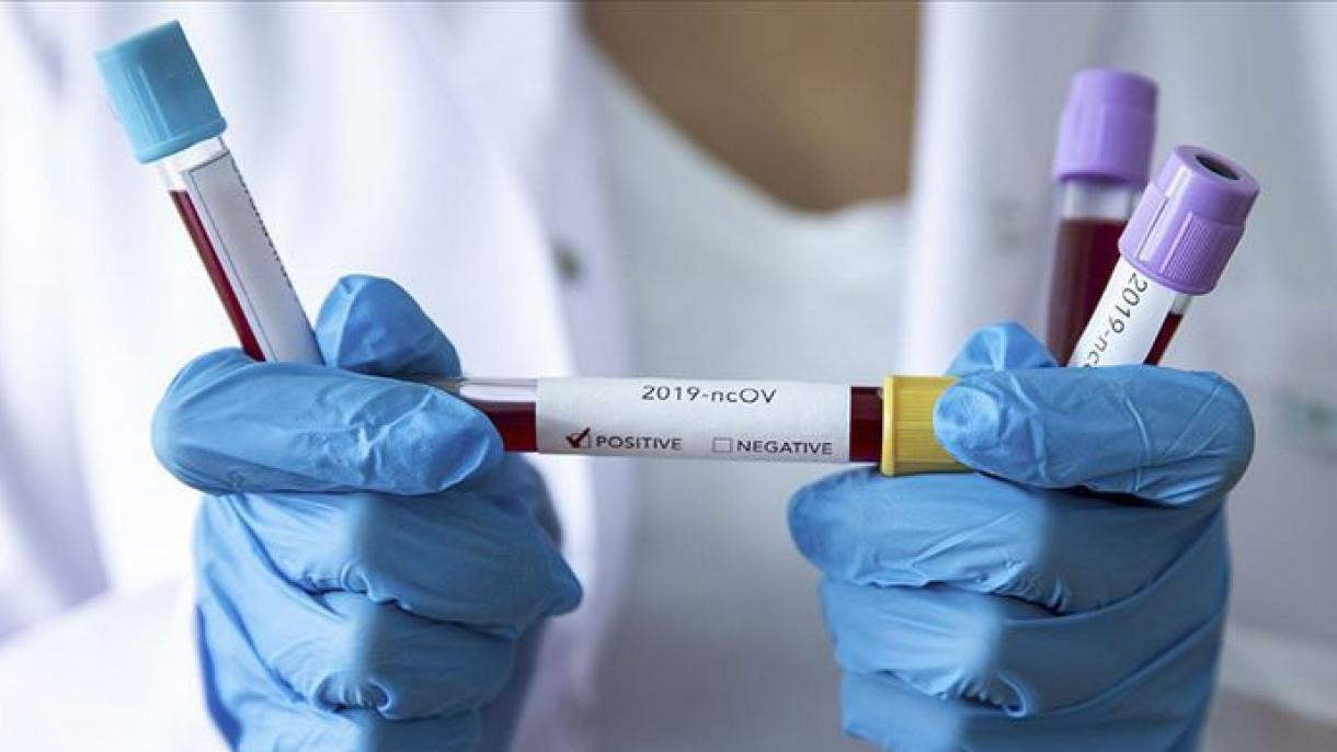 Putinin çıxışını dinləmək istəyənlərdən koronavirus və qrip testi tələb olunur