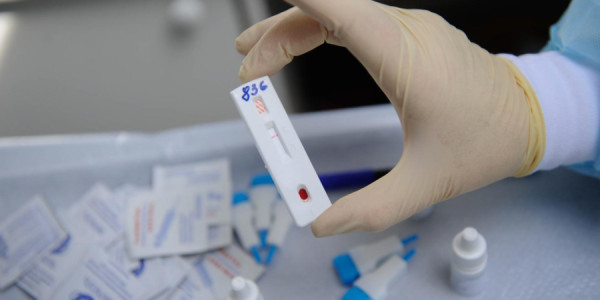 Rusiya vərəm, HİV və virus hepatitləri ilə mübarizə tədbirlərini yeniləyir