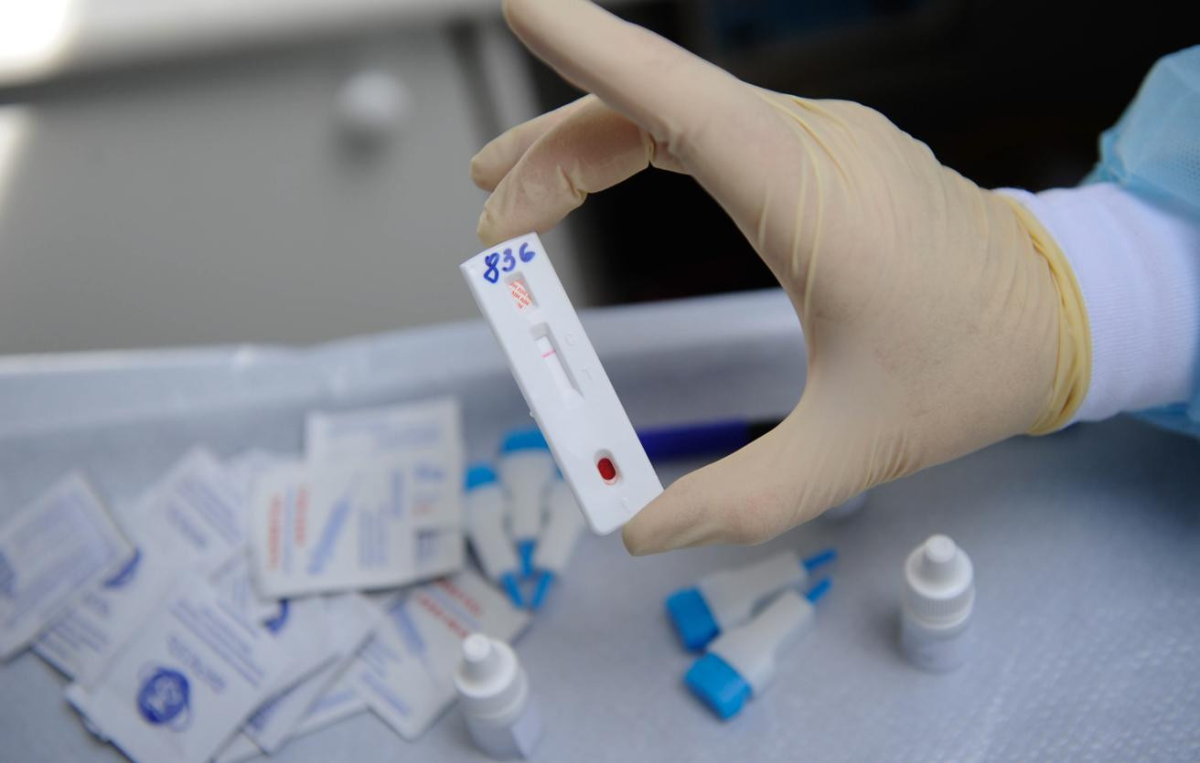 Rusiya vərəm, HİV və virus hepatitləri ilə mübarizə tədbirlərini yeniləyir