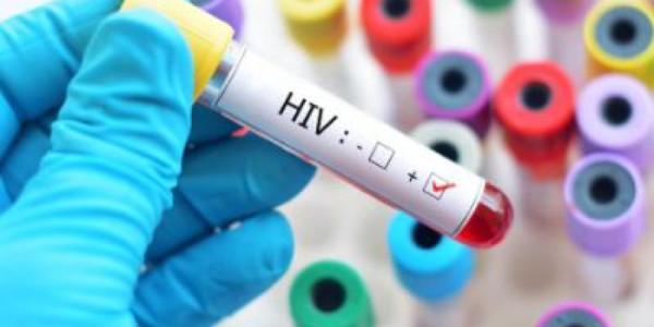 BMT xəbərdarlıq edir: Dünyanı yeni HİV epidemiyası təhdid edir