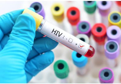 BMT xəbərdarlıq edir: Dünyanı yeni HİV epidemiyası təhdid edir