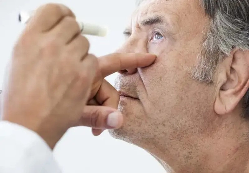 Alzheimerin ilk əlamətləri gözlərdə aşkarlana bilər
