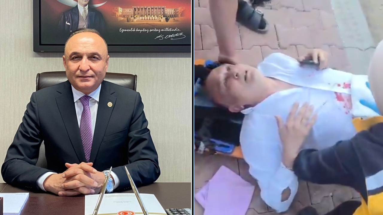 Türkiyədə deputata bıçaqlı hücum edilib