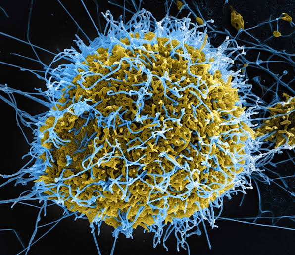 Virus Şimali Kivuda da yayıldı –