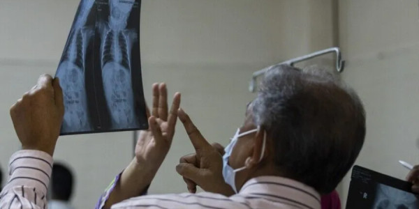 Banqladeşdə qızılca epidemiyası 1030 nəfərin ölümünə səbəb olub