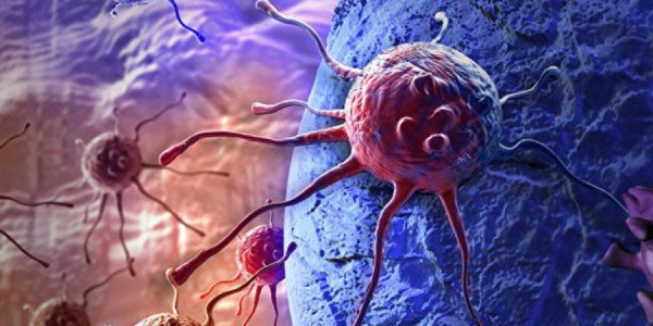 Xərçəngin izləri analizlərdə görünməyəndə nə baş verir? – Professor açıqladı
