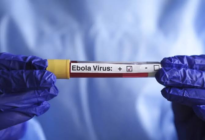 Konqoda Ebola epidemiyası 4 minə yaxın insanın ölümünə səbəb olub
