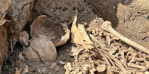 474 itkin şəxsin sümük qalıqlarında xəsarətlər aşkarlanıb
