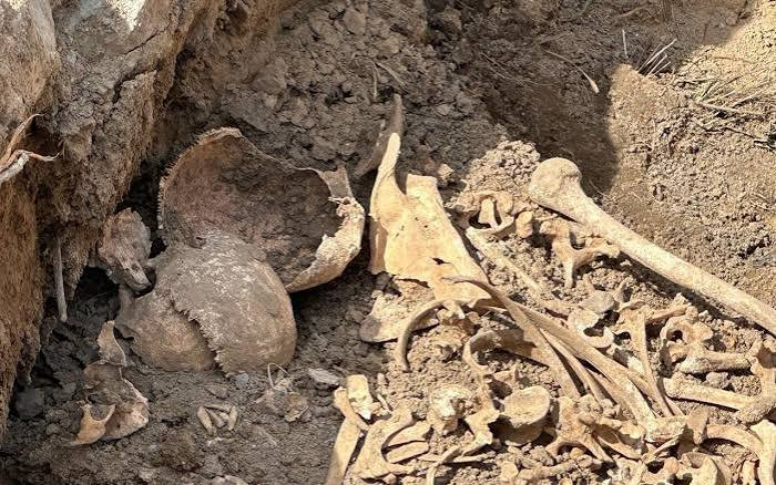 474 itkin şəxsin sümük qalıqlarında xəsarətlər aşkarlanıb