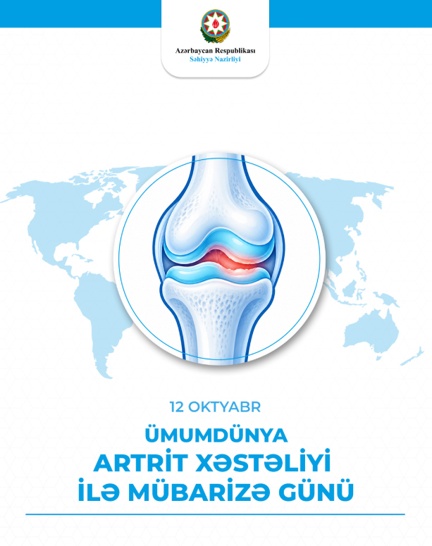 Revmatoid artritlə yaşayanlar nələrə diqqət etməlidir? – Səhiyyə Nazirliyinin revmatoloqdan tövsiyələr